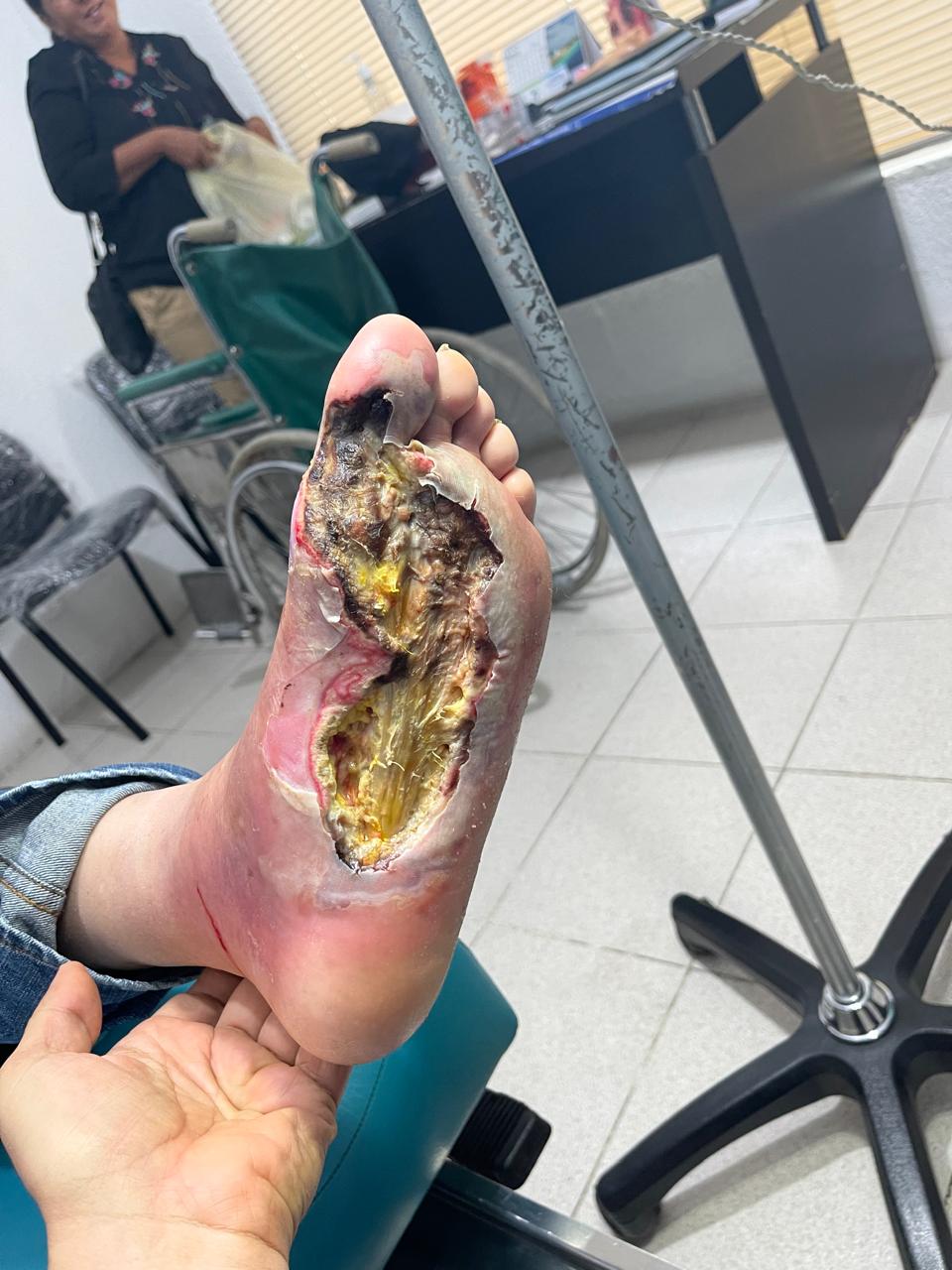Primera fotografía del caso clínico 01